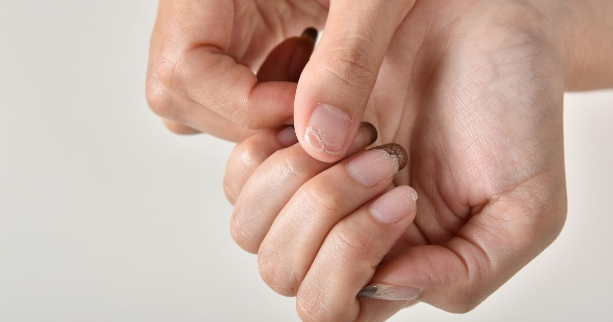why-nails-break 